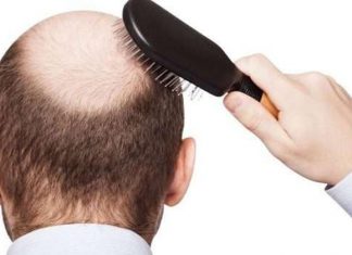 العثور على طريقة محتملة لعلاج الصلع العثور على طريقة محتملة لعلاج الصلع