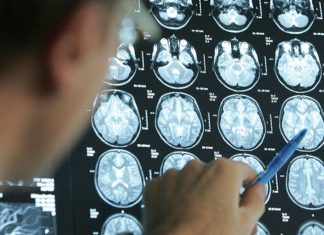 “عامل هام” يمكن أن يمنع نمو الدماغ! "عامل هام" يمكن أن يمنع نمو الدماغ!