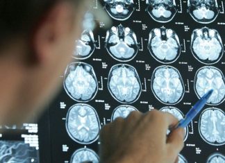 القيلولة تساعد في الحفاظ على صحة الدماغ القيلولة تساعد في الحفاظ على صحة الدماغ