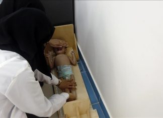 الأغذية العالمي: نقص التمويل يهدد 24 مليونا بالمجاعة العام المقبل الأغذية العالمي: نقص التمويل يهدد 24 مليونا بالمجاعة العام المقبل