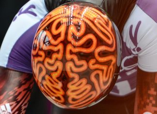 علماء روس يكتشفون الجين المسؤول عن شدة السكتة الدماغية علماء روس يكتشفون الجين المسؤول عن شدة السكتة الدماغية