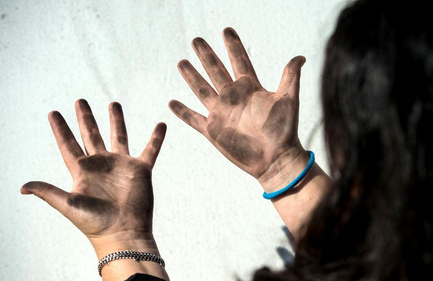 دراسة تحذر من مخاطر التسمم بالرصاص عالميا: 5 ملايين وفاة سنويا وأطفال أقل ذكاء دراسة تحذر من مخاطر التسمم بالرصاص عالميا: 5 ملايين وفاة سنويا وأطفال أقل ذكاء