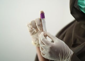 علماء يكشفون عن الجينات التي فاقمت كارثة الكوليرا في اليمن علماء يكشفون عن الجينات التي فاقمت كارثة الكوليرا في اليمن