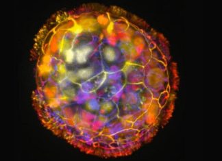 “الأنثروبوتس”.. خلايا بشرية تصنع روبوتا حيا لا يشبه الإنسان "الأنثروبوتس".. خلايا بشرية تصنع روبوتا حيا لا يشبه الإنسان