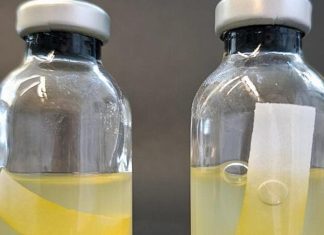 صبغة صفراء تبتكر وقودًا وتقتل الجراثيم صبغة صفراء تبتكر وقودًا وتقتل الجراثيم