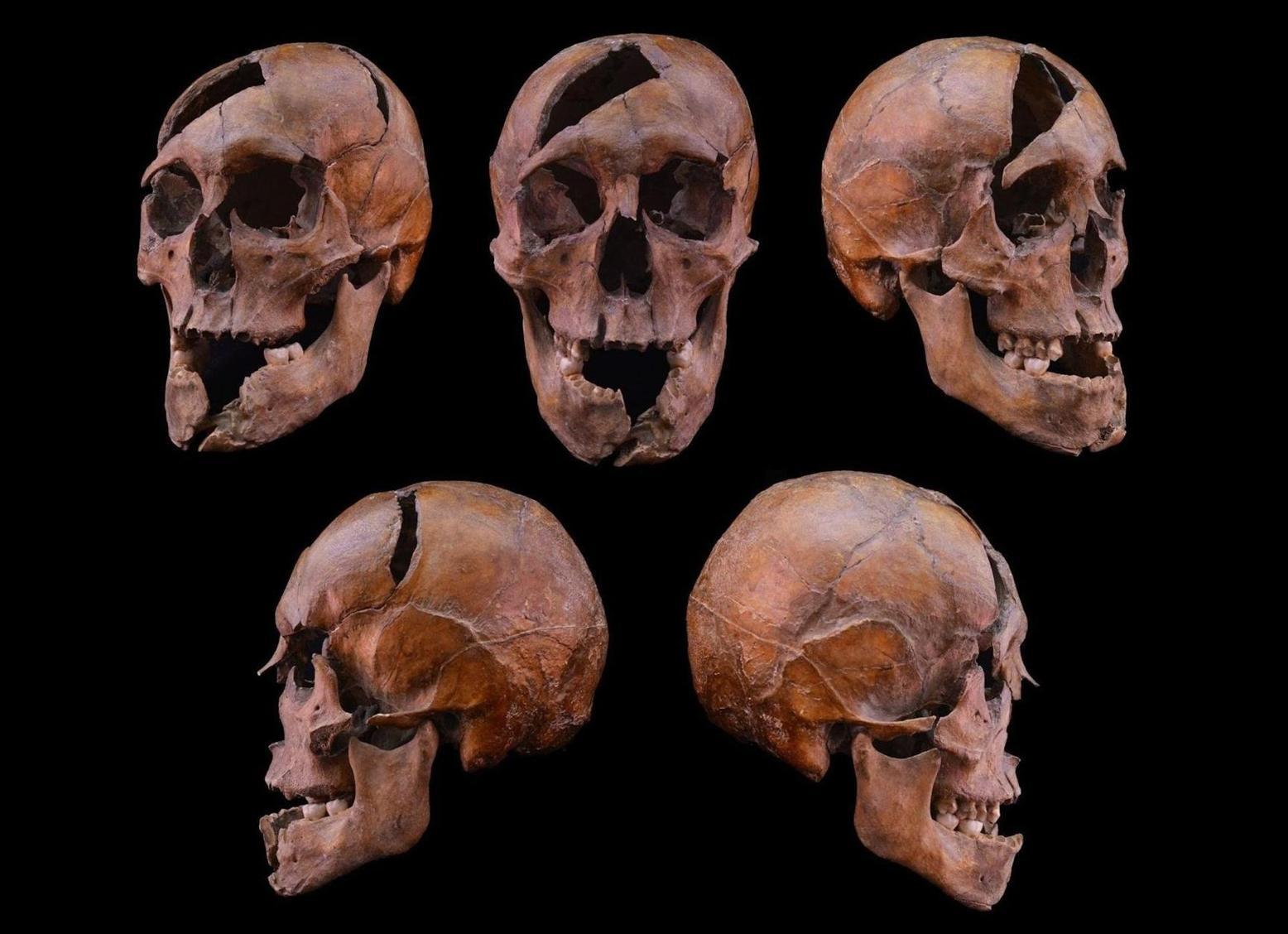 بعد 700 سنة.. العلم يحل لغز جريمة هزّت البلاط الهنغاري بعد 700 سنة.. العلم يحل لغز جريمة هزّت البلاط الهنغاري