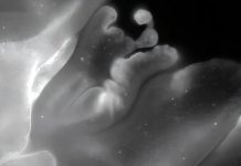 “حيوان بلا دماغ في البحر الأحمر يطوي جسده بدقة” "حيوان بلا دماغ في البحر الأحمر يطوي جسده بدقة"