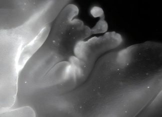 “حيوان بلا دماغ في البحر الأحمر يطوي جسده بدقة” "حيوان بلا دماغ في البحر الأحمر يطوي جسده بدقة"