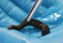 20 دولارا للواحدة.. ما سبب تهريب “دودة العلق” إلى تركيا؟ 20 دولارا للواحدة.. ما سبب تهريب "دودة العلق" إلى تركيا؟