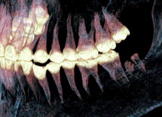 في سيبيريا.. اكتشاف أطراف اصطناعية استخدمت قبل 2500 عام في سيبيريا.. اكتشاف أطراف اصطناعية استخدمت قبل 2500 عام