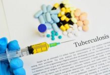 TANZANIA LEADS AFRICA IN FIGHT AGAINST TB
