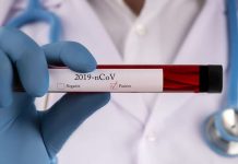 COVID-19 vaccines are safe- ECOSOCC Official