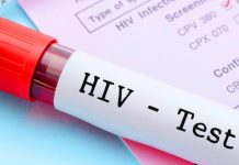 STATE SETS ASIDE FUNDS TO BOOST YOUTH LIVING WITH HIV/AIDS