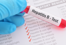 CALL FOR TANZANIANS TO UNDERGO HEPATITIS B SCREENING