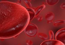 MNH EXPANDS DOMESTIC HAEMOPHILIA SERVICE CARE