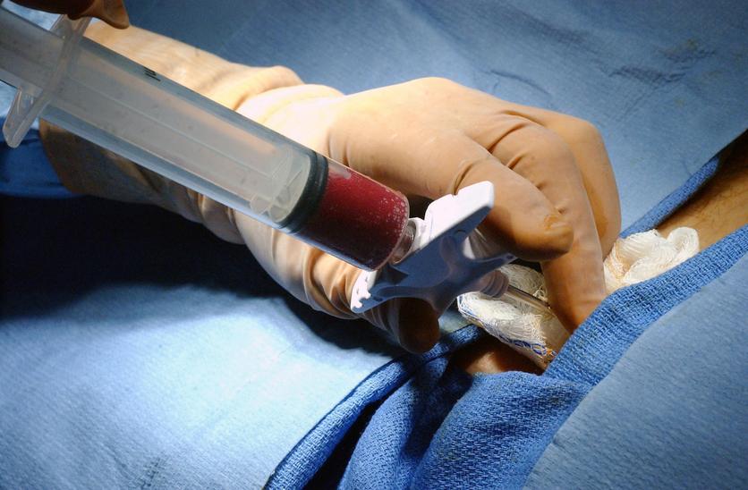 Milestone as MNH starts offering bone marrow transplant services Milestone as MNH starts offering bone marrow transplant services