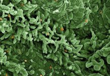 Mpox: strain 1b in focus to understand lethality Mpox: strain 1b in focus to understand lethality