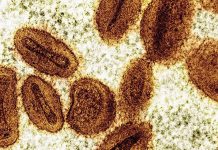 Mpox and Marburg Virus Outbreaks Strain Central and East Africa’s Health Systems Mpox and Marburg Virus Outbreaks Strain Central and East Africa's Health Systems