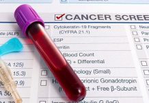 Redefining cancer treatment in Tanzania Redefining cancer treatment in Tanzania