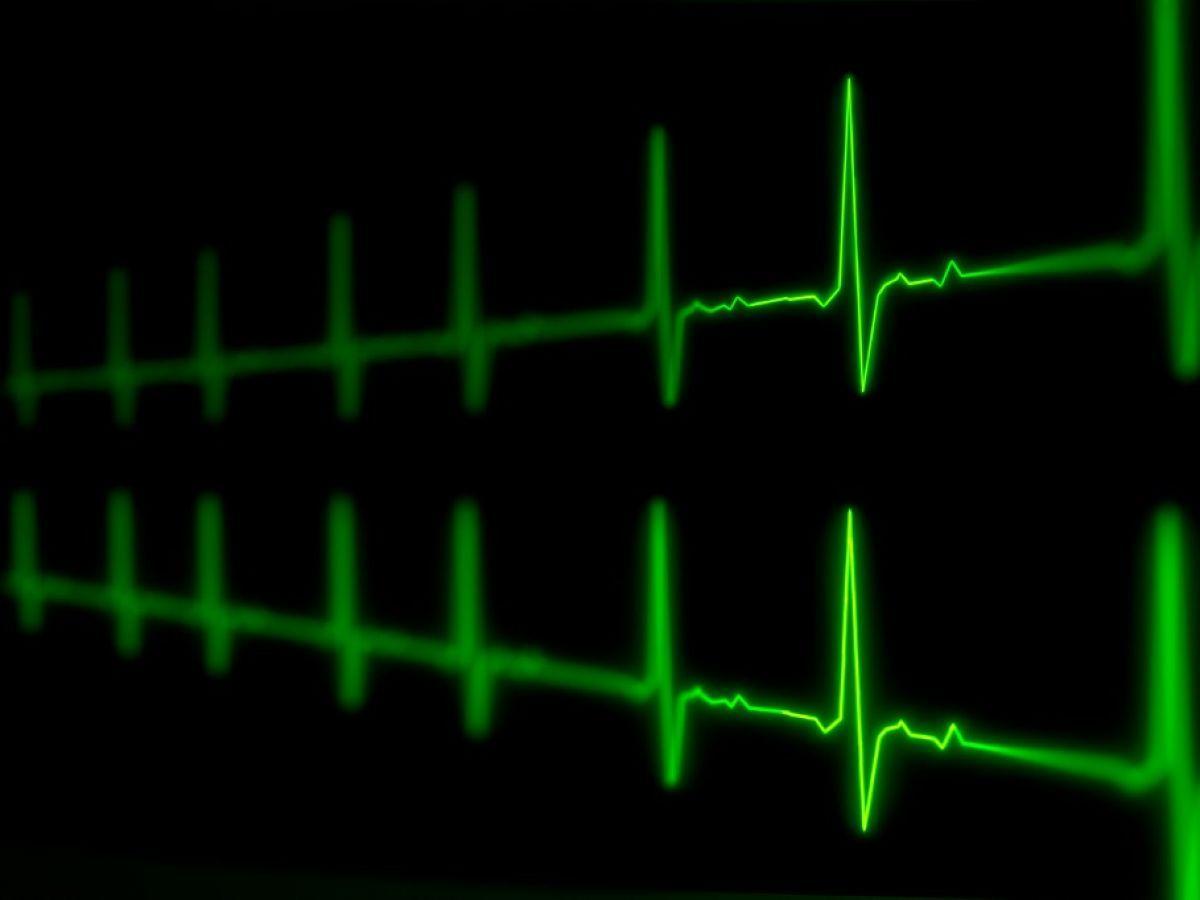 Une équipe allemande développe le premier ventricule artificiel battant Une équipe allemande développe le premier ventricule artificiel battant