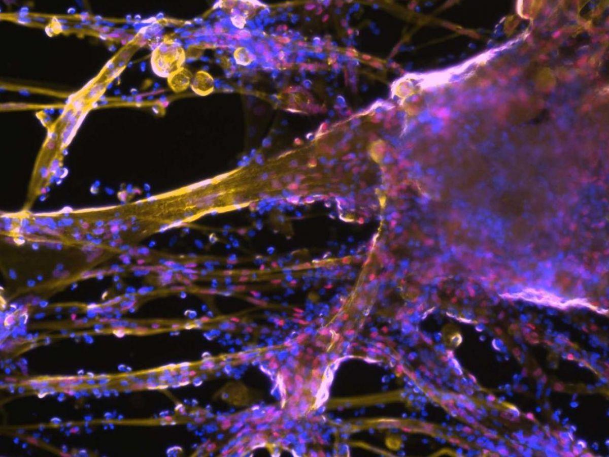 Des cellules musculaires créées en laboratoire grâce à une nouvelle technique Des cellules musculaires créées en laboratoire grâce à une nouvelle technique