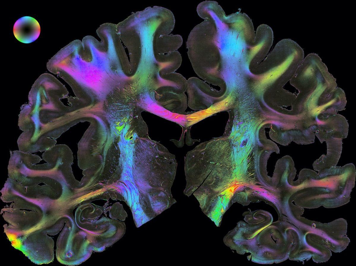 Le Human Brain Project s'achève, bilan de la course au cerveau virtuel Le Human Brain Project s'achève, bilan de la course au cerveau virtuel