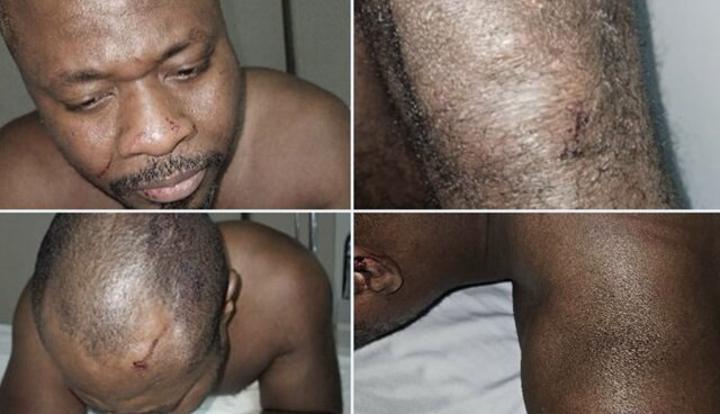 Togo/Violence d´état contre le député Guy Marius Sagna, ou l´ultime avertissement de Faure Gnassingbé aux Togolais : moi ou le chaos. Togo/Violence d´état contre le député Guy Marius Sagna, ou l´ultime avertissement de Faure Gnassingbé aux Togolais : moi ou le chaos.