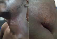 Un Responsable Local De Togo Espoir Blessé À La Machette Un Responsable Local De Togo Espoir Blessé À La Machette