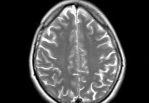 « Cortex »: aux Sources de L’Intellect Humain "Cortex": aux Sources de L'Intellect Humain