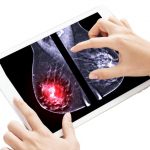 Quart Des Femmes Diagnostiquées Ont Moins De 50 Ans Quart Des Femmes Diagnostiquées Ont Moins De 50 Ans