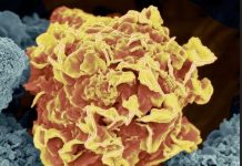 Le cancer à l’épreuve des IA génératives Le cancer à l'épreuve des IA génératives