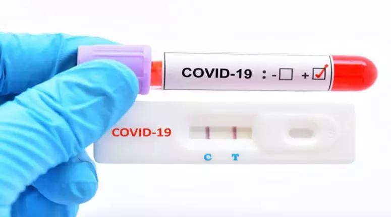 كورونا: 16 وفاة و841 إصابة جديدة كورونا: 16 وفاة و841 إصابة جديدة