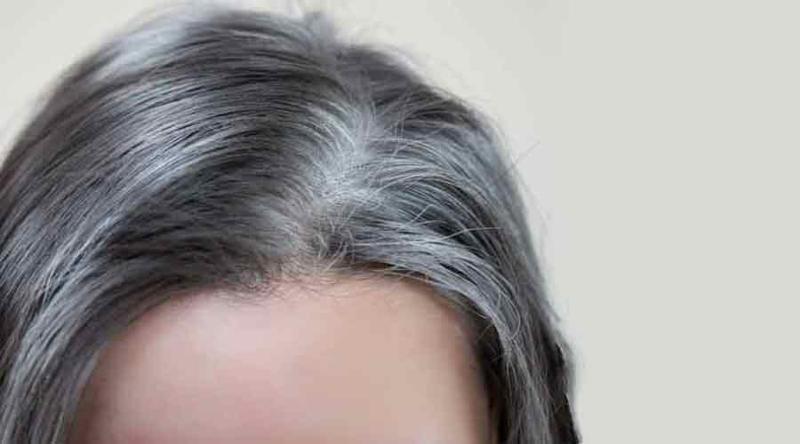 هل يسبّب التوتر شيب الشعر؟ هل يسبّب التوتر شيب الشعر؟