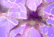 دواء رخيص يتناوله مرضى السكري يقلل من خطر الإصابة بالخرف دواء رخيص يتناوله مرضى السكري يقلل من خطر الإصابة بالخرف