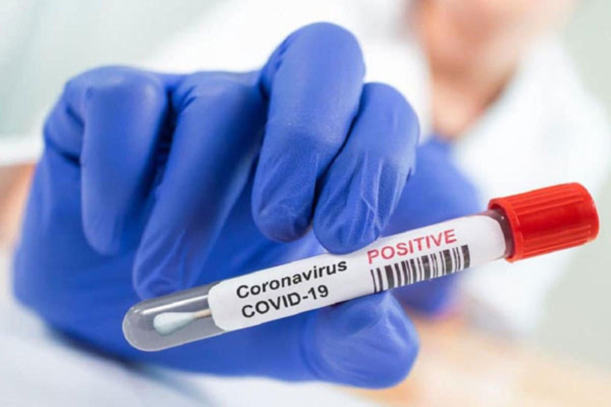 1,800 new Covid-19 cases confirmed in Uganda 1,800 new Covid-19 cases confirmed in Uganda