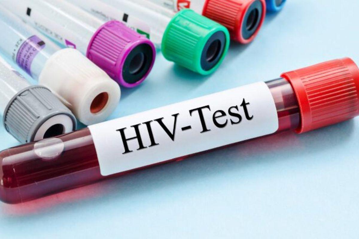 HIV prevalence drops, says govt HIV prevalence drops, says govt