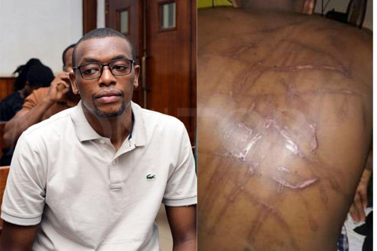 HRW urges Uganda to investigate Kakwenza's torture claims HRW urges Uganda to investigate Kakwenza's torture claims