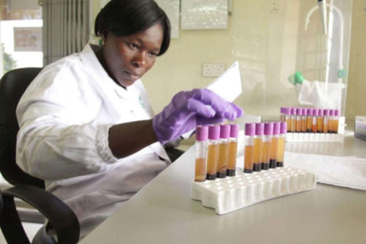 Aids killing 46 Ugandans daily – minister Aids killing 46 Ugandans daily – minister