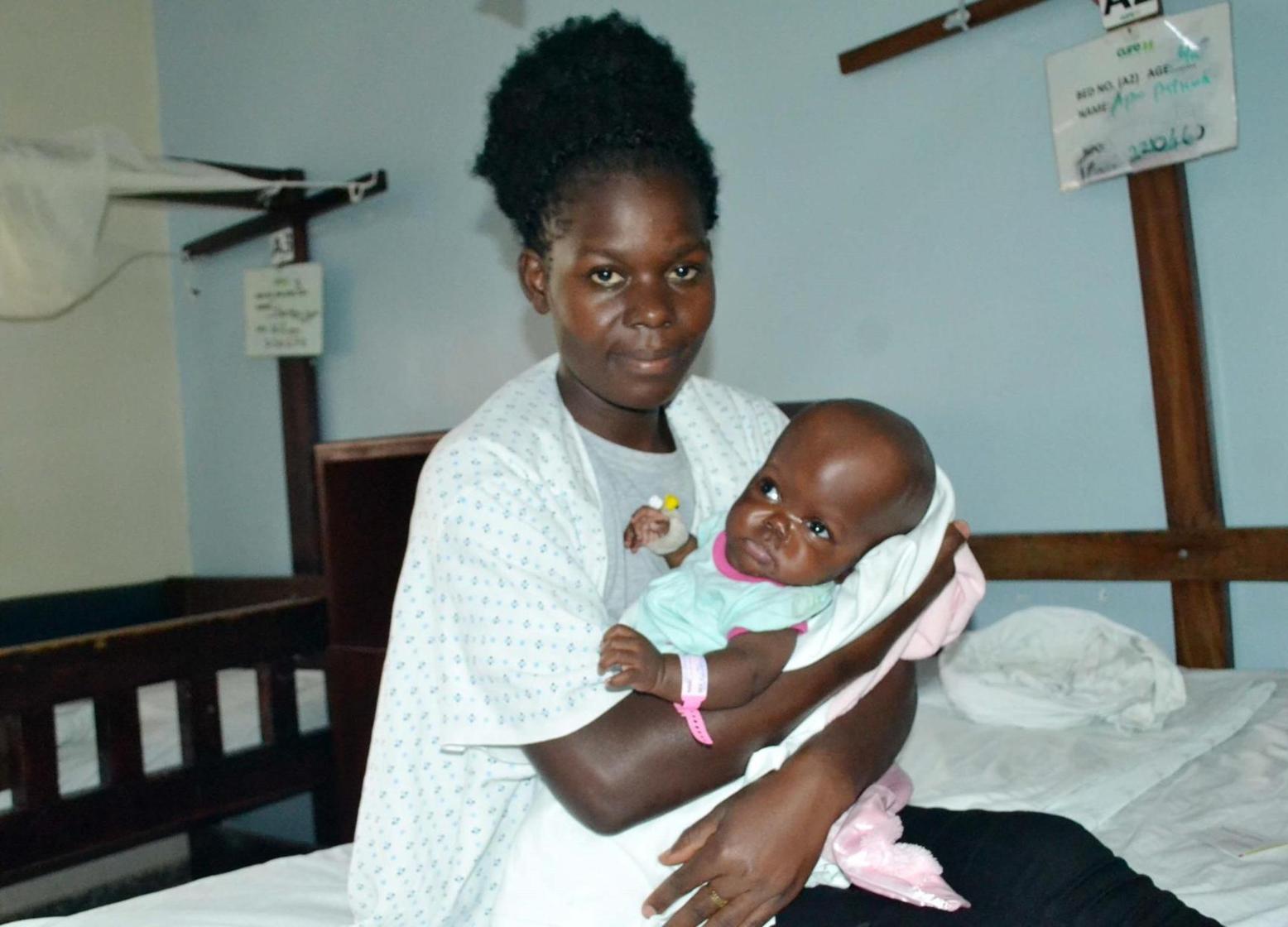 experts-root-for-early-treatment-for-children-with-hydrocephalus-uganda