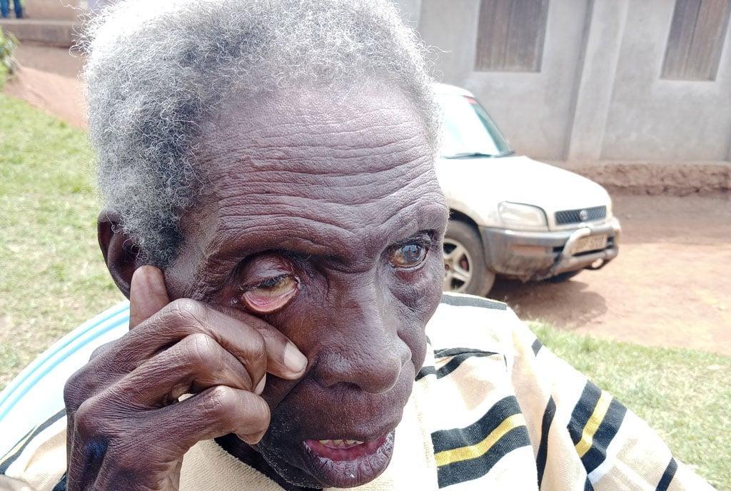 River blindness leaves scars amid successes River blindness leaves scars amid successes