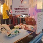 How Uganda is Advancing in Ensuring Premature Babies Survive How Uganda is Advancing in Ensuring Premature Babies Survive