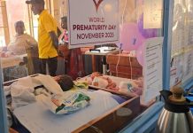 How Uganda is Advancing in Ensuring Premature Babies Survive How Uganda is Advancing in Ensuring Premature Babies Survive