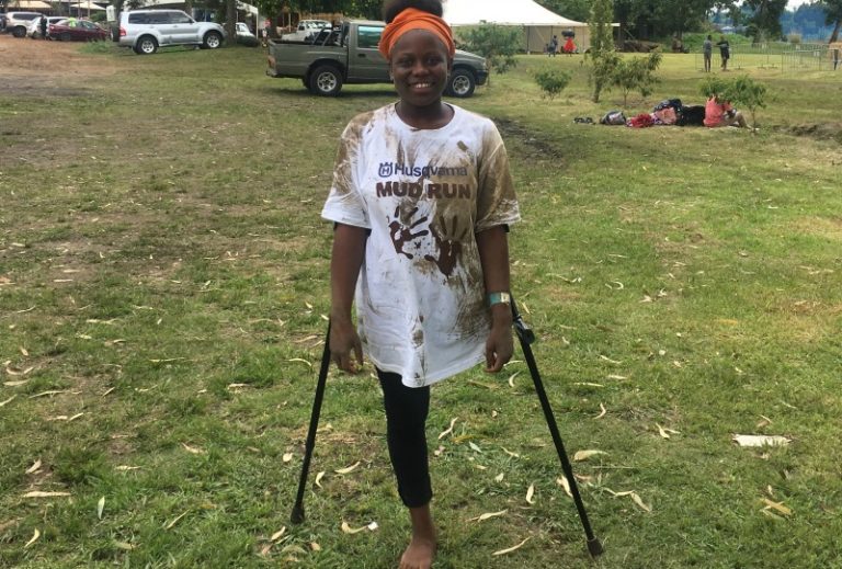 Brave 18-year-old cancer amputee says leading a complete life
