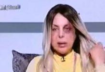 بالصور : مذيعات مصريات تعرضن للضرب والعنف والطلاق على الهواء