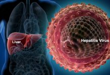 برلماني: يتقدم بطلب إحاطة بعد سحب مستحضرsofoheb” ” لعلاج فيروس سي