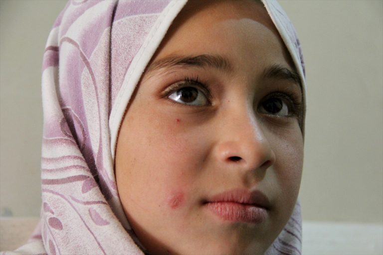 الرشيدية : محاربة داء الليشمانيا في اطار لجنة اقليمية