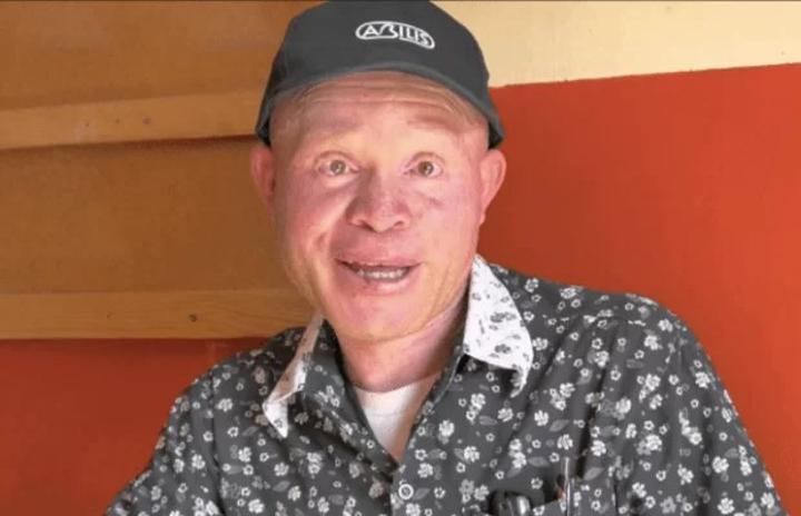 There are falsehoods that albinos’ body parts bring good luck or attract wealth- John Chiti There are falsehoods that albinos’ body parts bring good luck or attract wealth- John Chiti