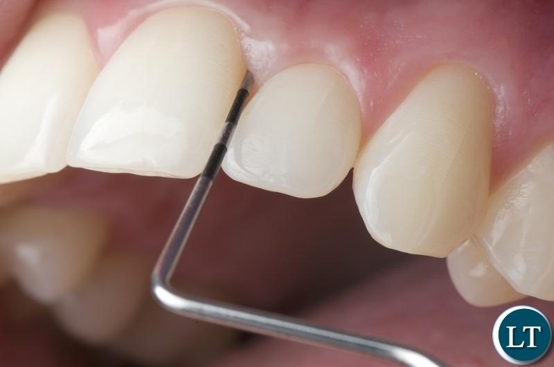 Chipangali man directed to stop extracting people’s teeth using traditional methods Chipangali man directed to stop extracting people’s teeth using traditional methods