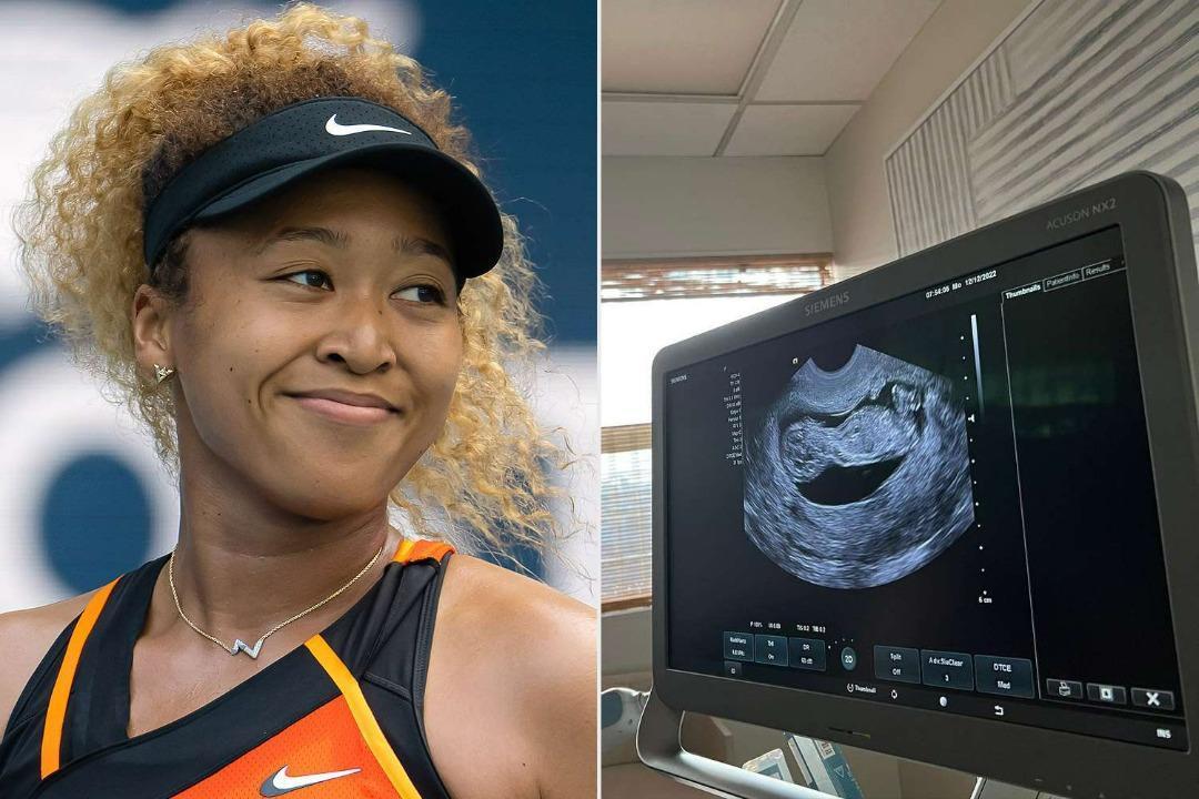 Naomi Osaka has announced that she is expecting her first child, and plans to return to tennis in 2024 Naomi Osaka has announced that she is expecting her first child, and plans to return to tennis in 2024