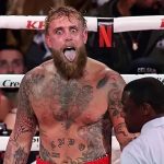 Paul has titanium plates fitted after Joshua breaks his jaw Paul has titanium plates fitted after Joshua breaks his jaw